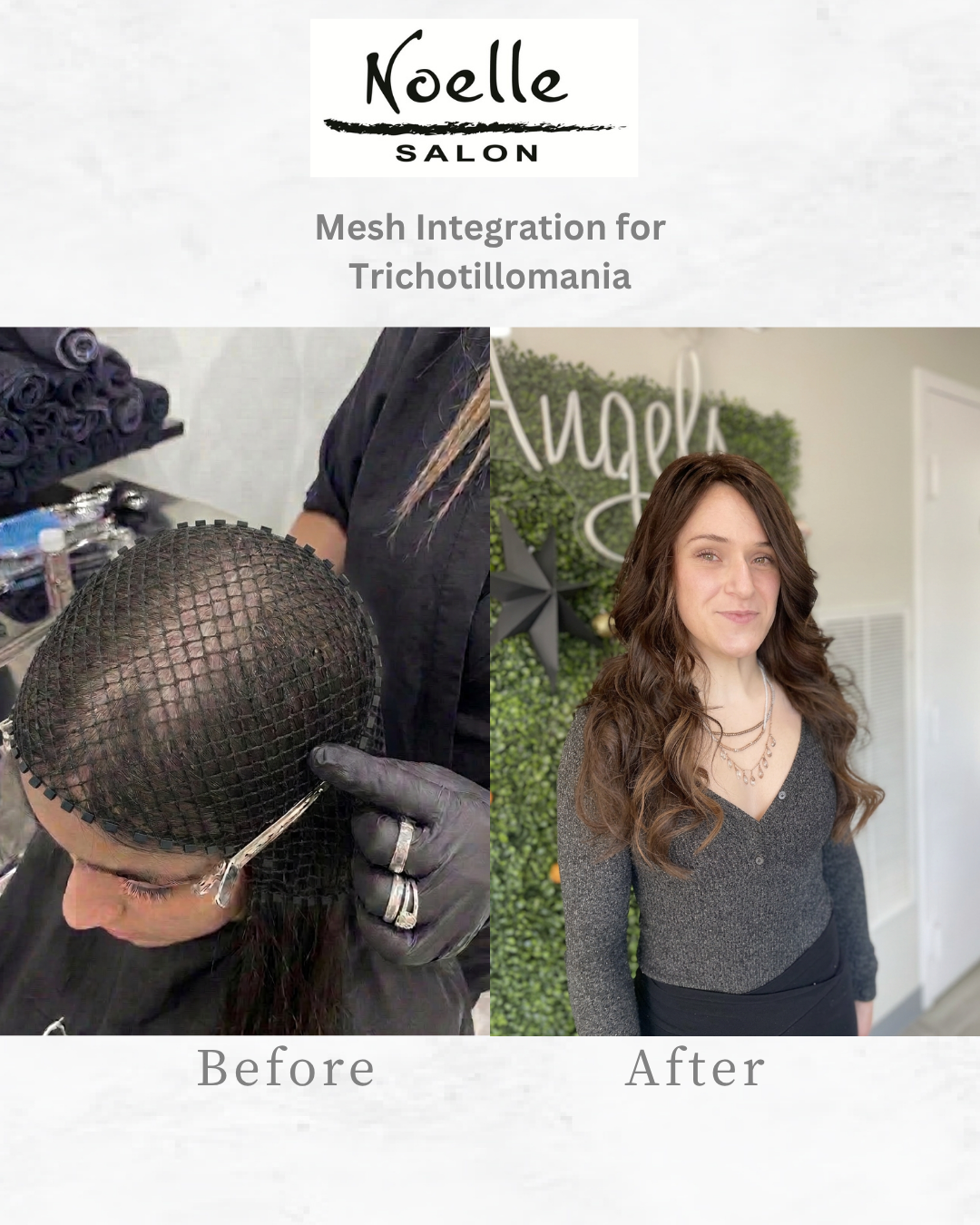 Mesh integration before and after transformation showing natural-looking density and scalp coverage for thinning hair.