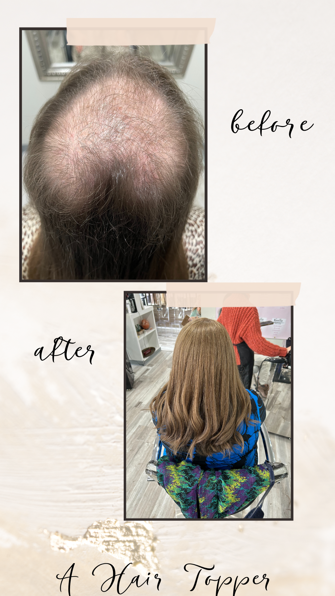 a before and after of a hair loss solution for a woman with alopecia