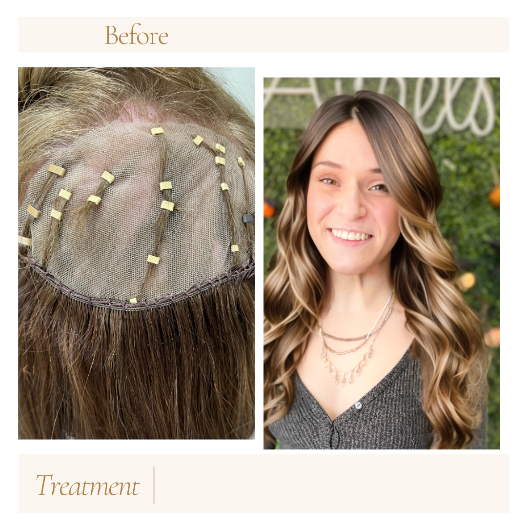 Natural Hair Toppers for Thinning Hair: Affordable Options Boston, MA