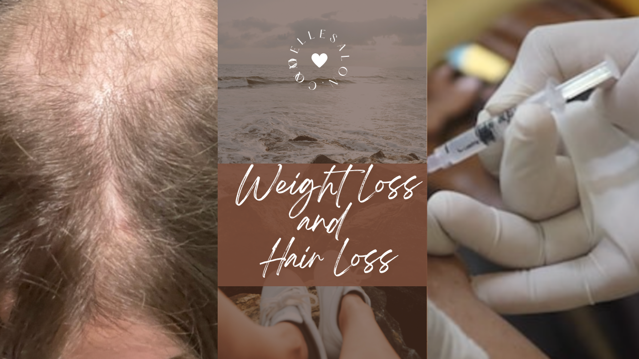 Weight Loss and Hair Loss: Unveiling the Relationship