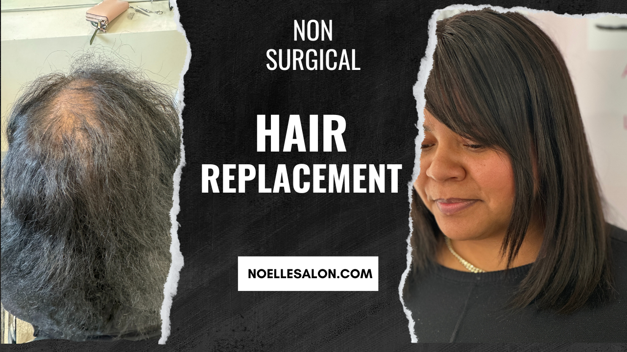 Achieve Hair Replacement Non Surgical: Simple Steps Boston, Mass.