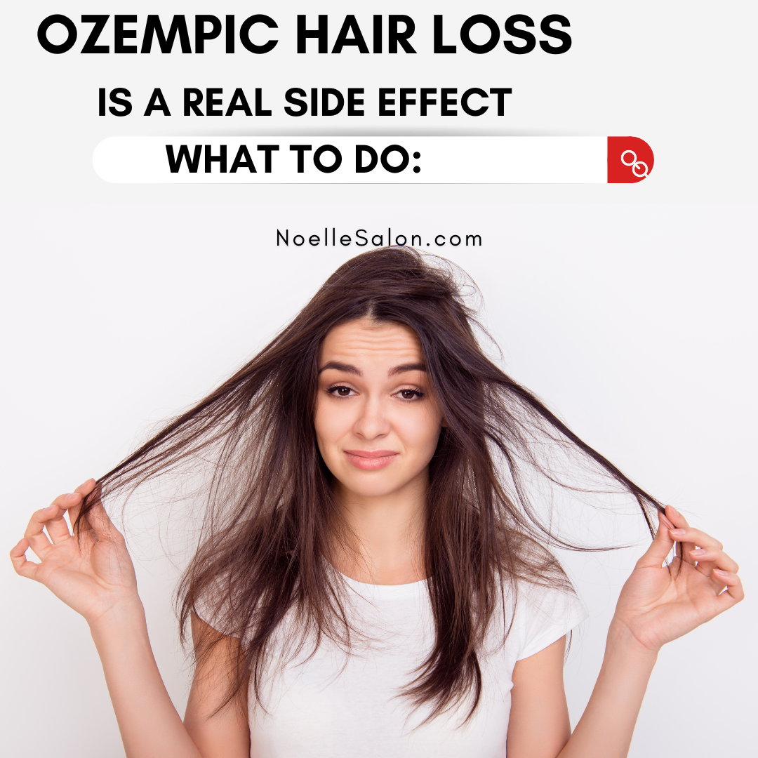 how to stop hair loss from ozempic