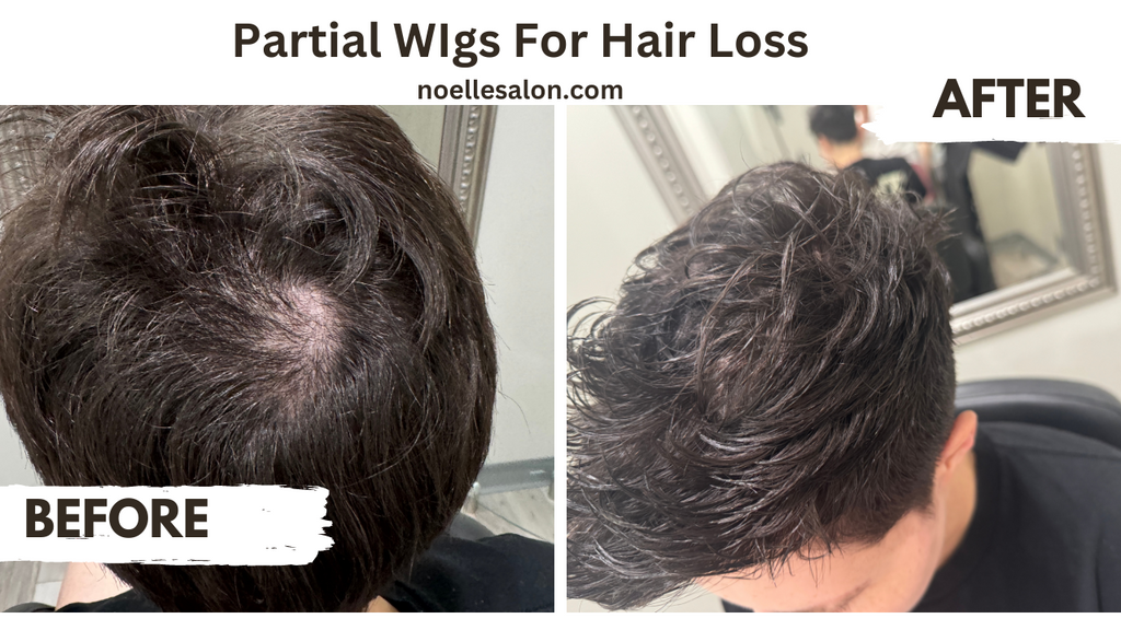 partial wigs for hair loss