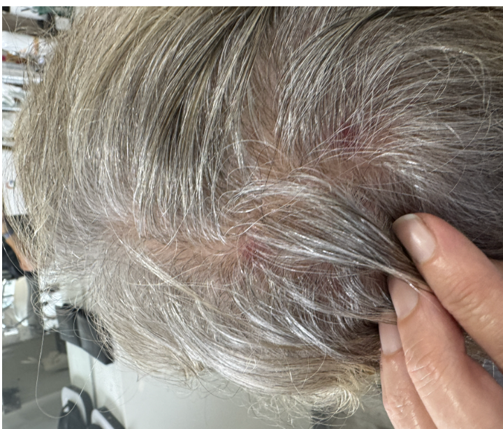 Noelle Salon stylist evaluating a client's scalp during a consultation