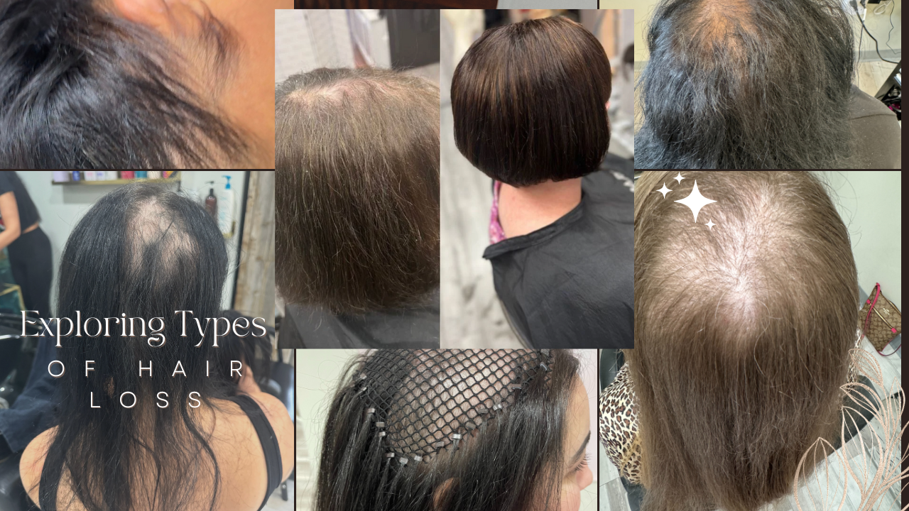 Best Hair Loss Treatment Near Me Options