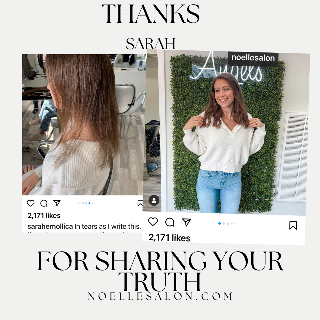 Sarah Carlo & Sarah Hair Loss Journey
