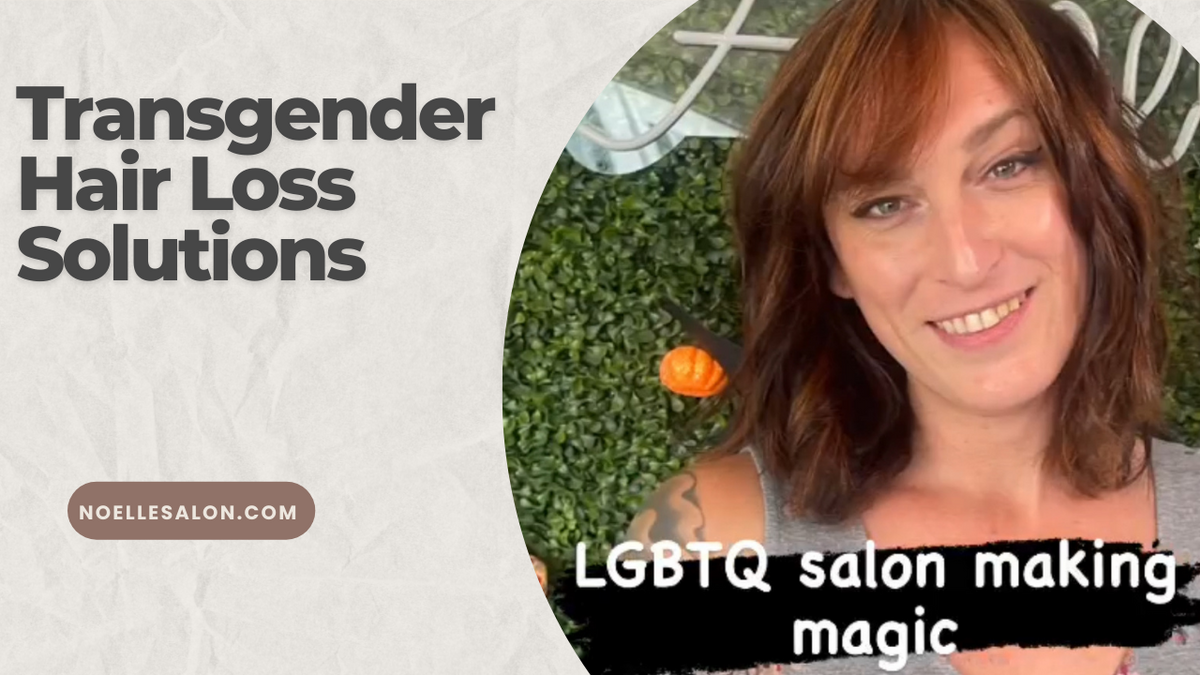transgender hair loss solutions