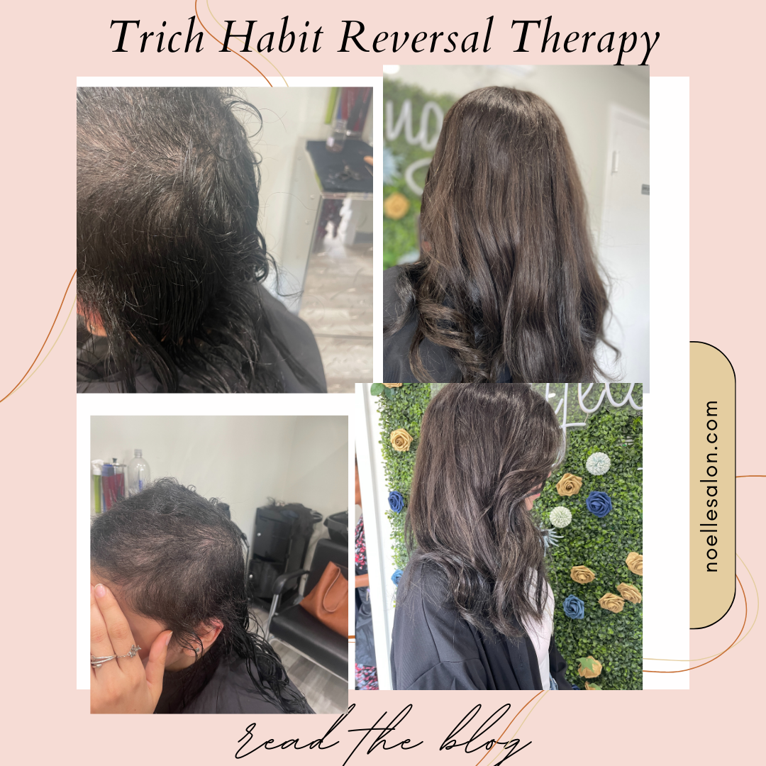 Trichotillomania Habit Reversal Therapy