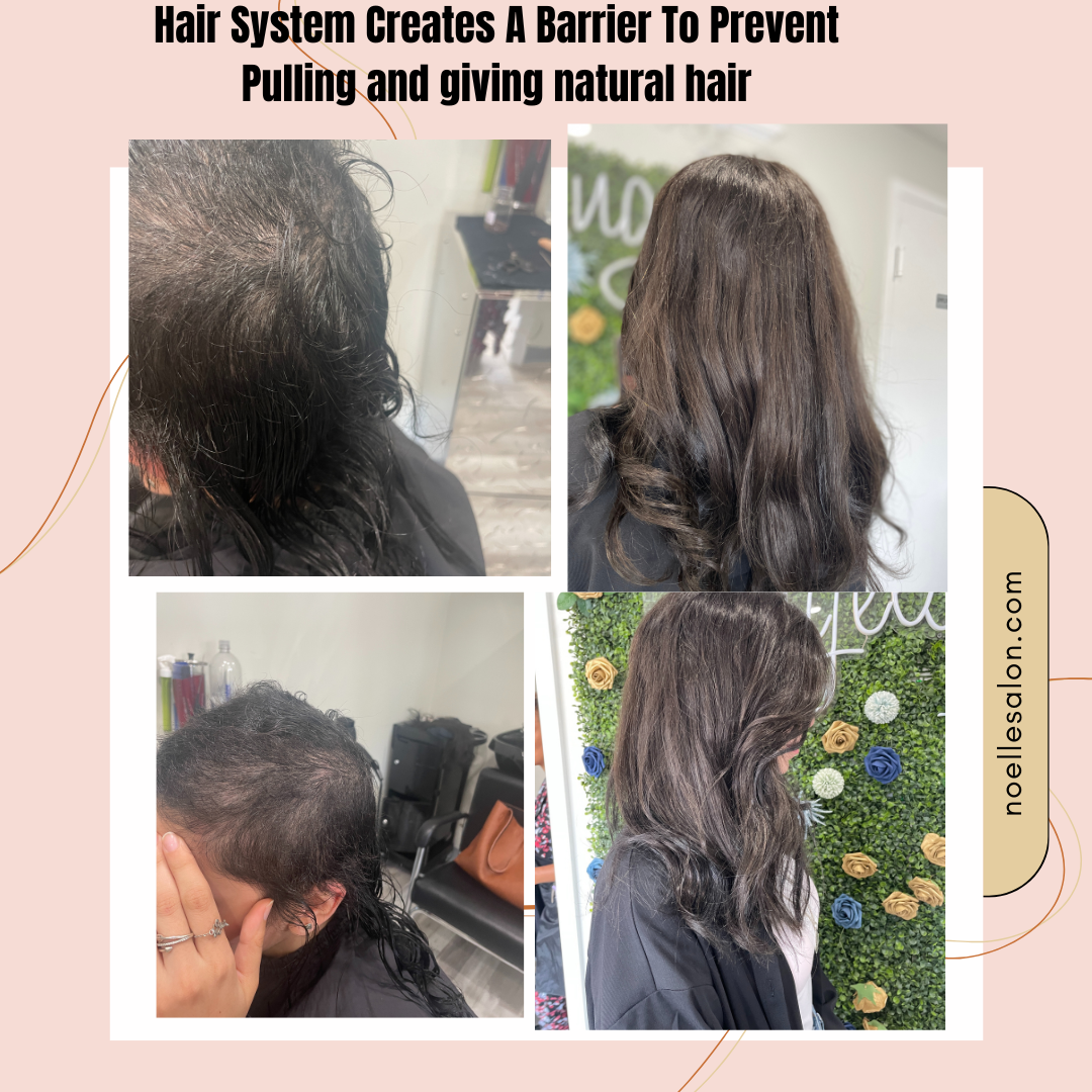 trichotillomania success stories