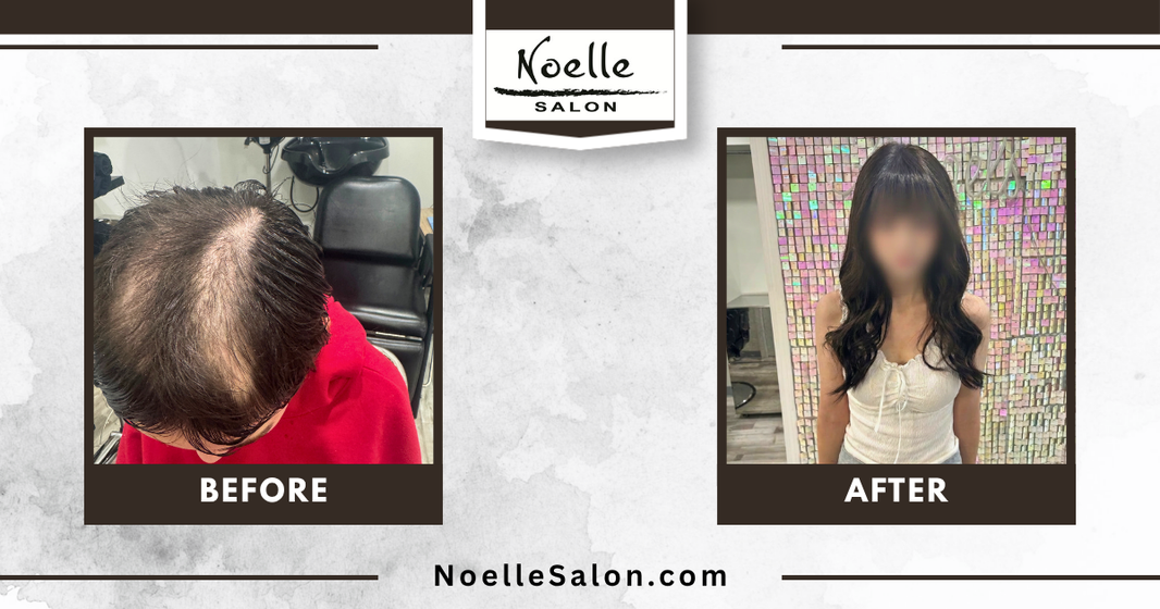 Trichotillomania hair loss before and after transformations at Noelle Salon Boston using custom hair toppers, mesh integration, and hair extensions