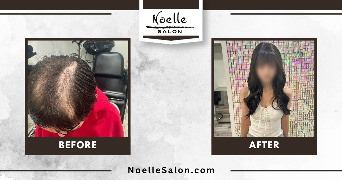 Trichotillomania hair loss before and after transformations at Noelle Salon Boston using custom hair toppers, mesh integration, and hair extensions