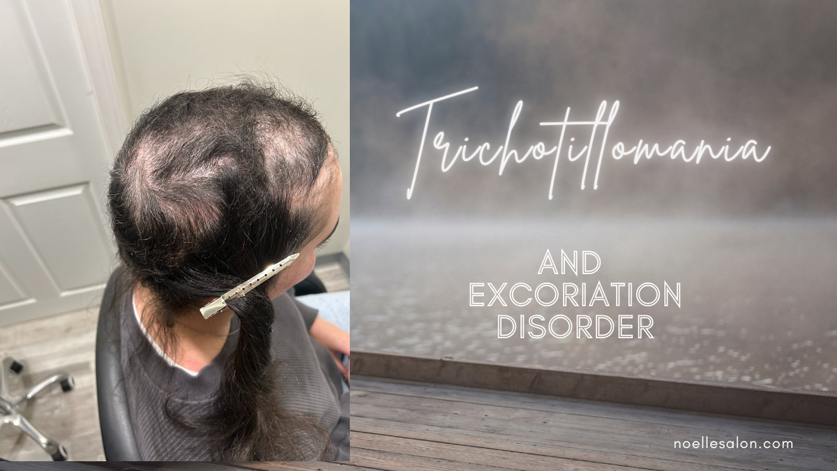 Managing trichotillomania