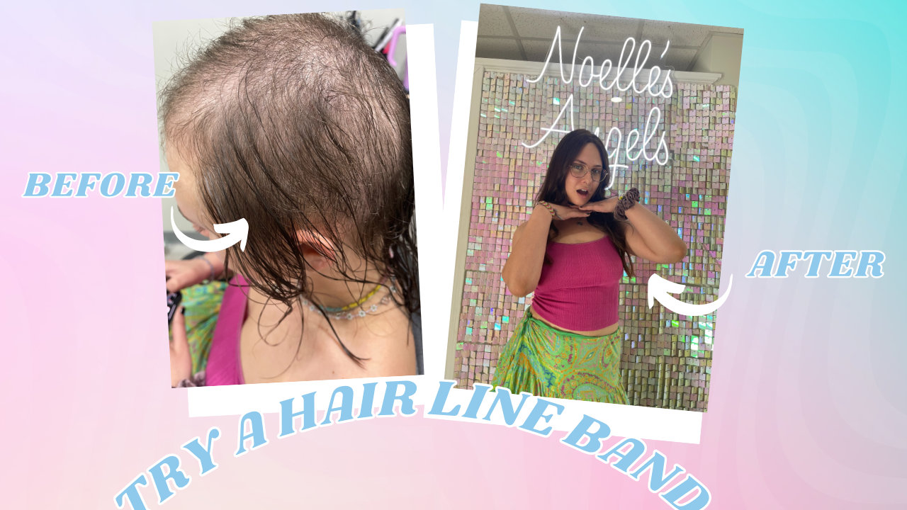 hairline band for hair loss
