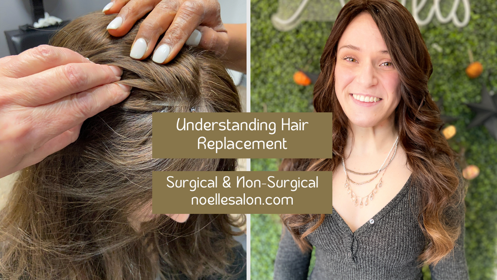 Hair Replacement in Boston Surgical and Non-Surgical