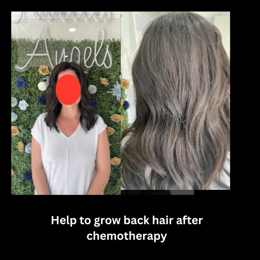 A client's journey to grow back her hair after chemotherapy.