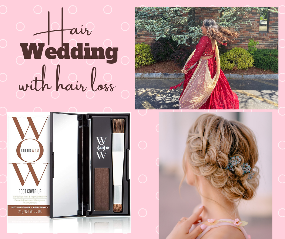 What To Do If You Are A Bride With Hair Loss?
