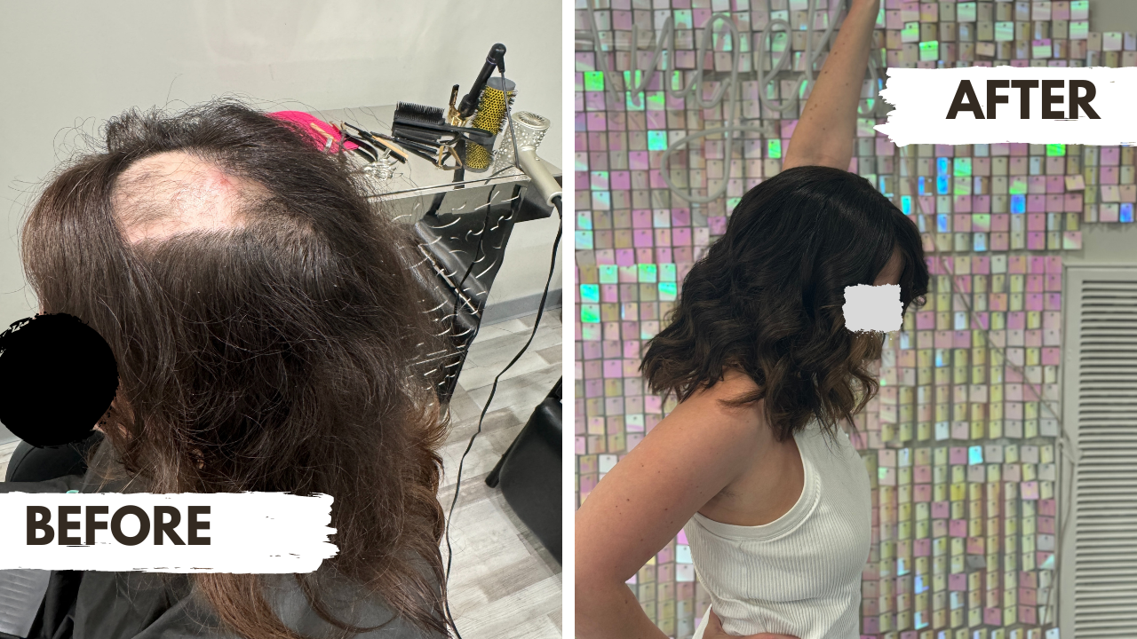 Alopecia wigs and toppers