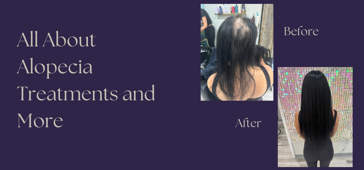 all about alopecia