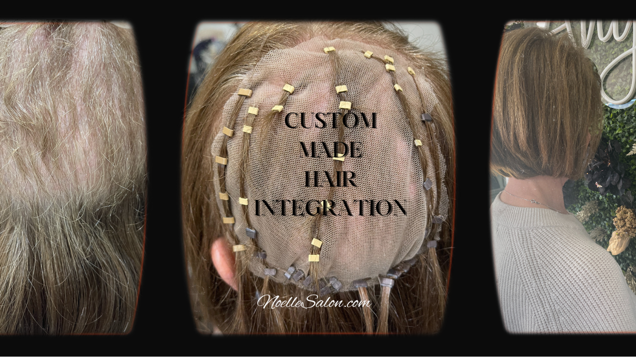 silk mesh integration hair loss system