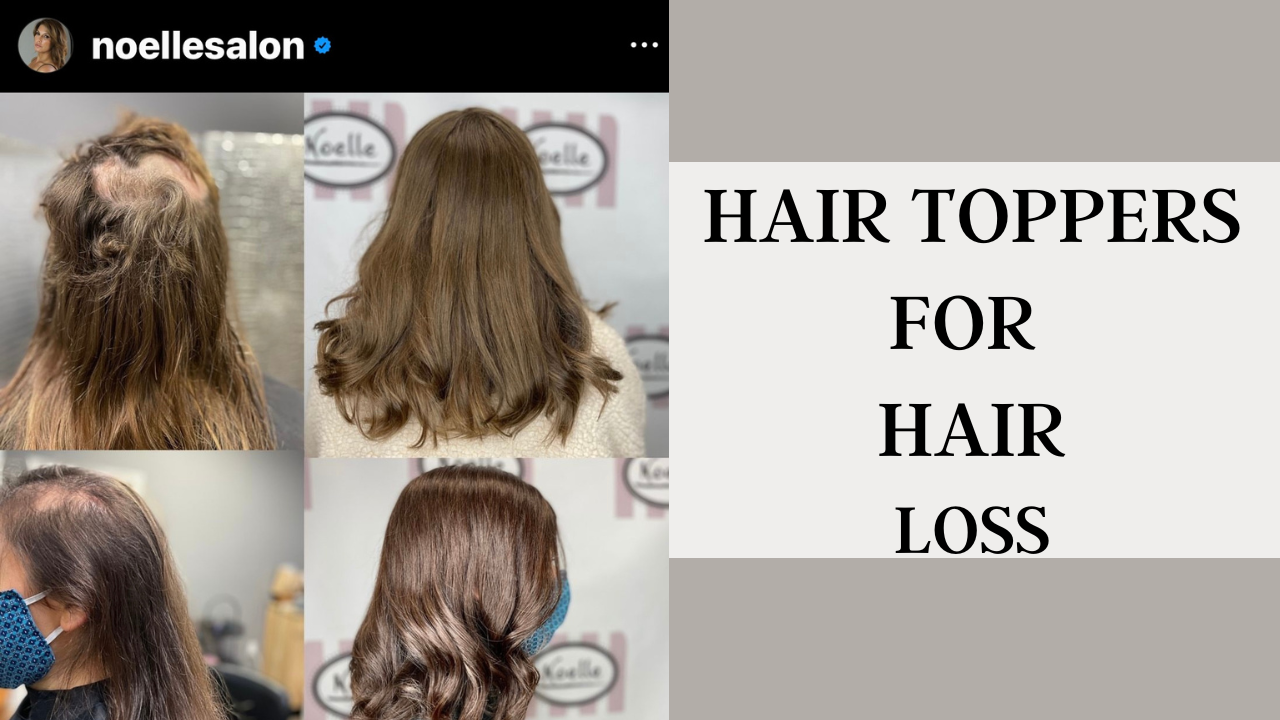 Transform Your Look with Noelle's Hair Toppers for Hair Loss Massachusetts