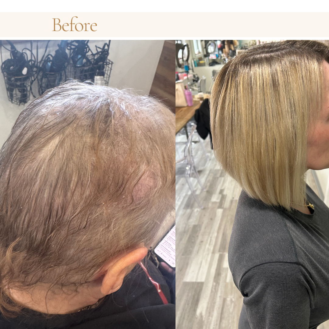 Hair topper before and after transformation for female pattern hair loss and crown thinning