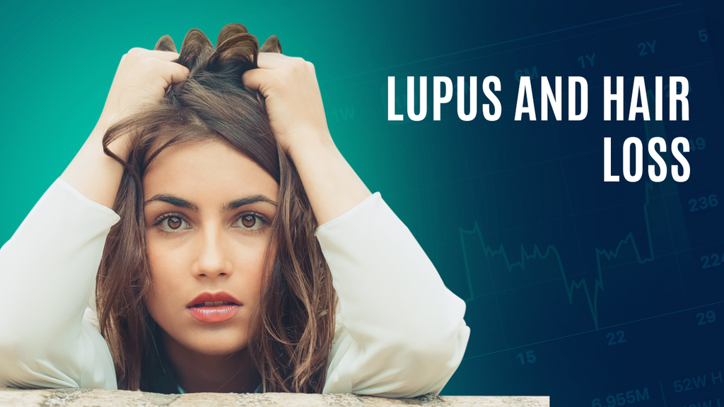 Lupus Hair Loss