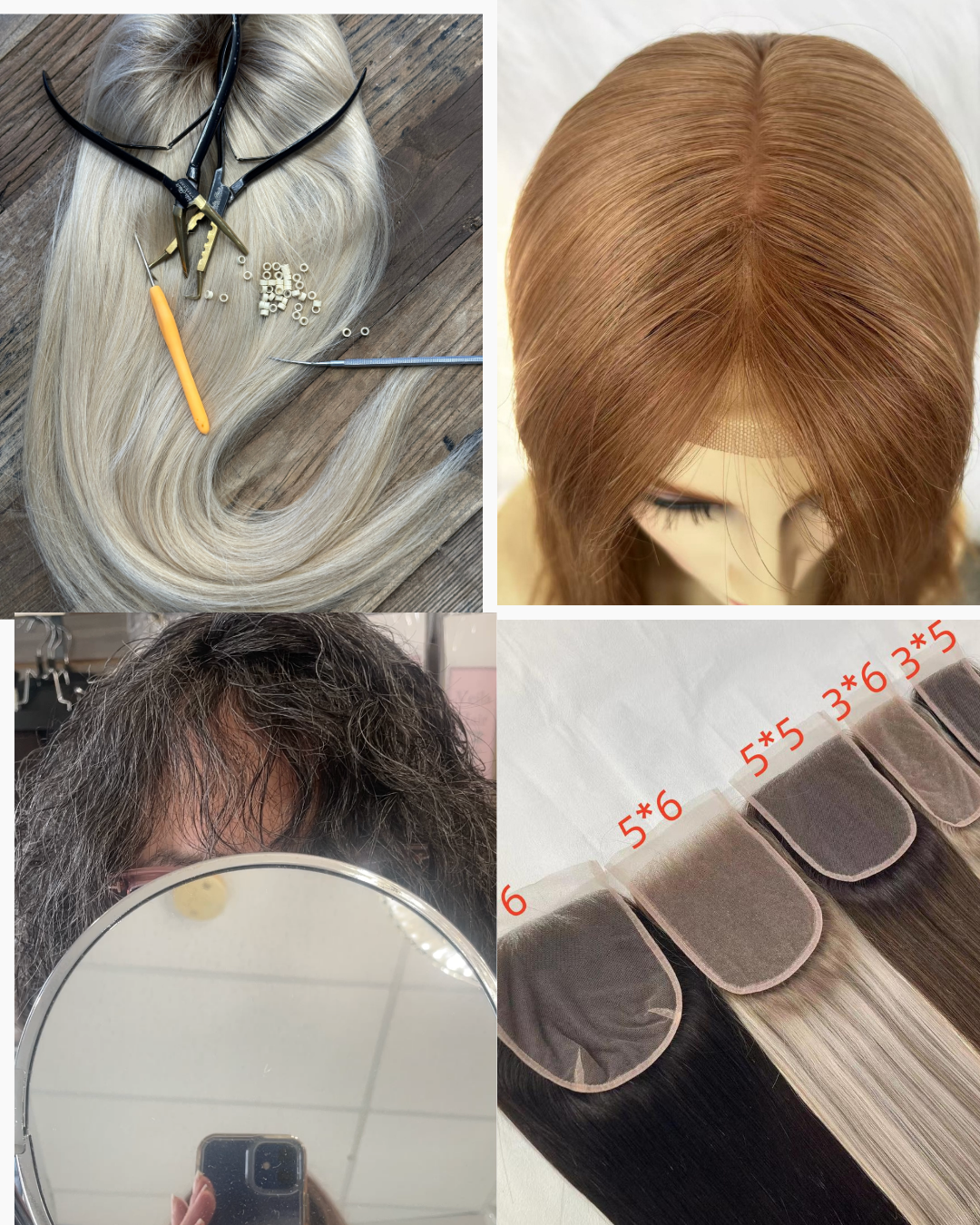 Types of medical hair prosthesis solutions including toppers mesh integration and closures