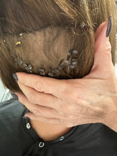 A free hair loss consultation