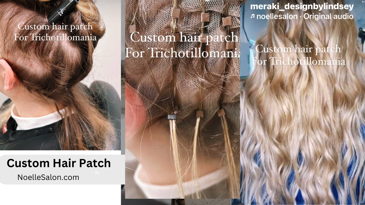 Mesh Integration Hair Loss System