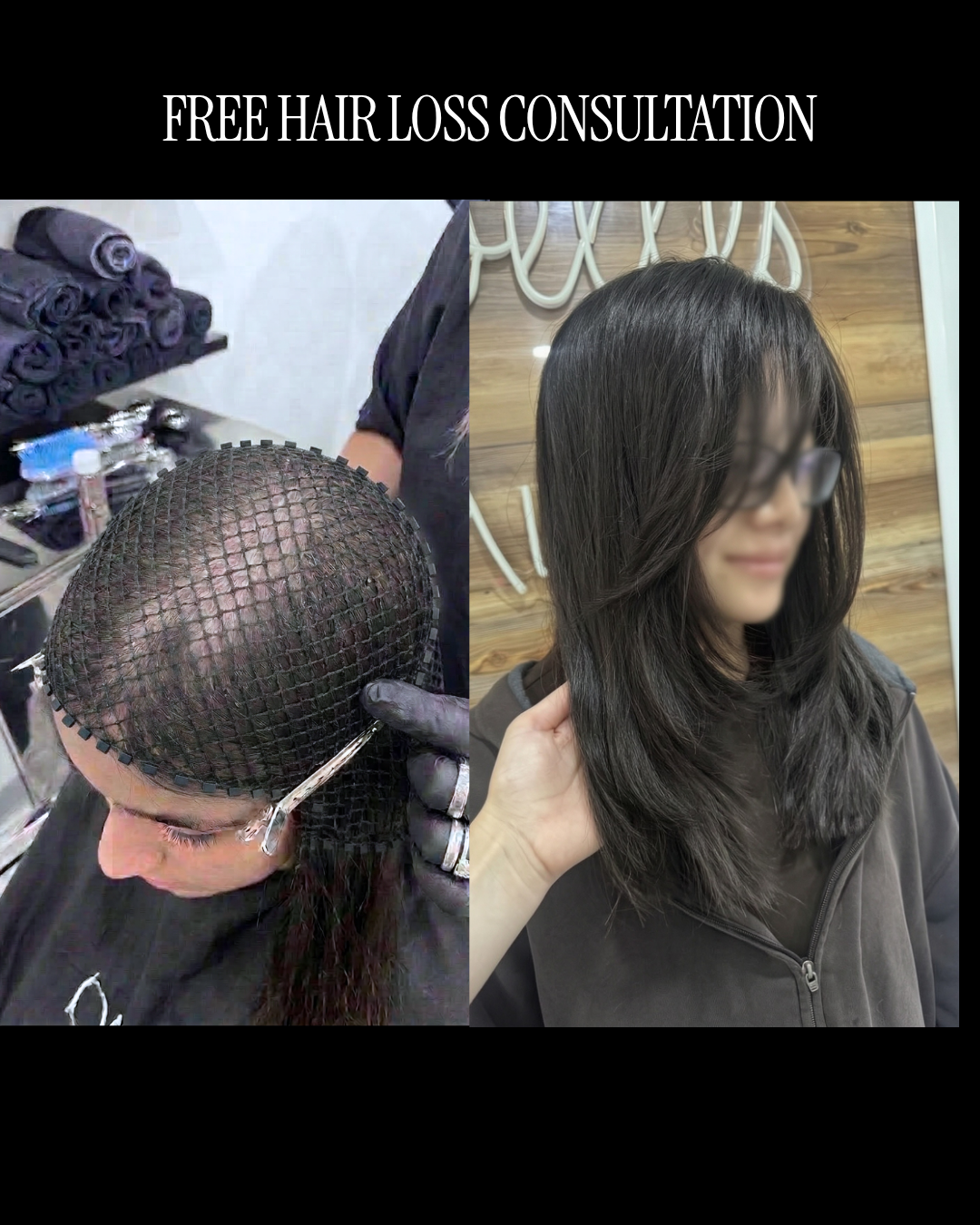 A Free Hair Loss Consultation (Wigs, Toppers & Hair Systems) — Boston Area
