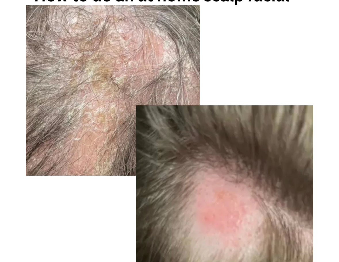 scalp massage before and after