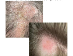 scalp massage before and after