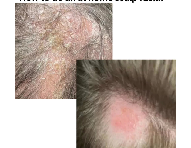 scalp massage before and after