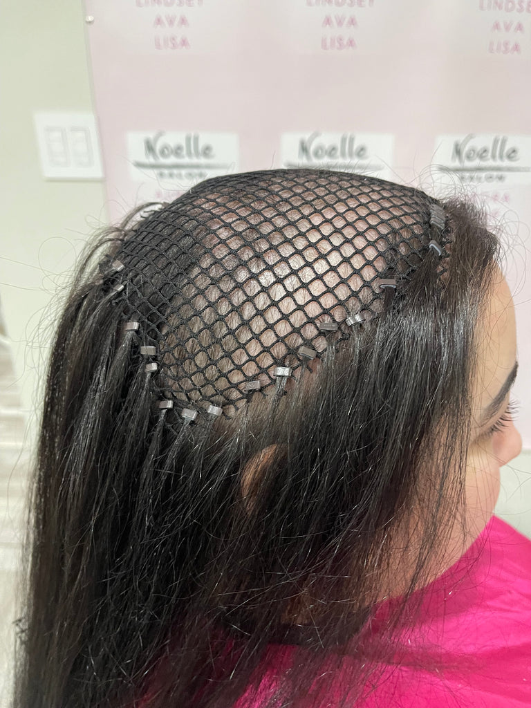 Mesh integration hair loss system to prevent hair pulling