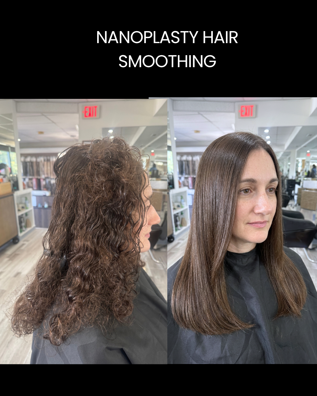Nanoplasty (Nanoplastia) Hair Treatment Boston-1
