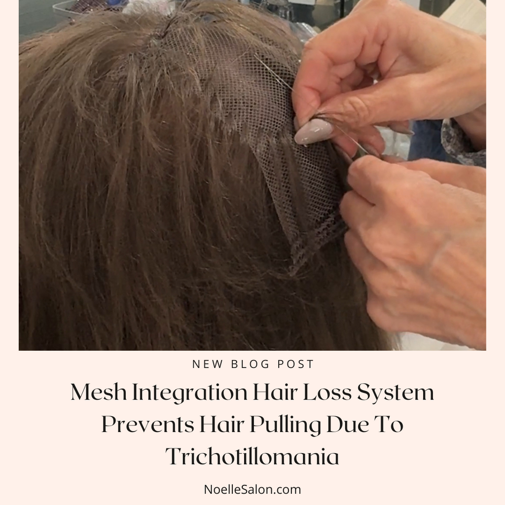 mesh integration hair loss sytem for trichotillomania