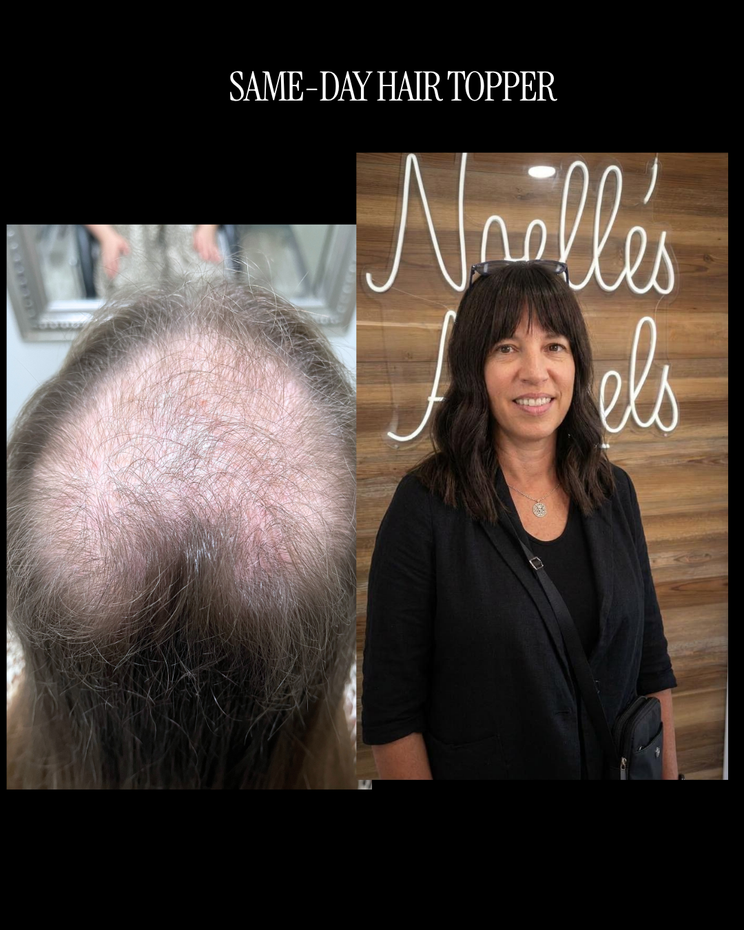 Same-Day Hair Topper Appointment (Consult + Fit + Apply) — Boston Area