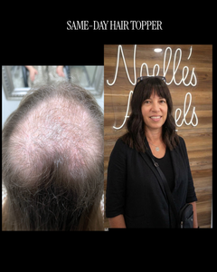 Same-Day Hair Topper Appointment (Consult + Fit + Apply) — Boston Area-2