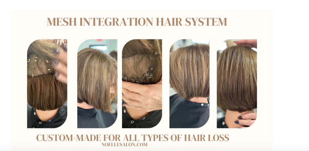 A free hair loss consultation with possible same-day service