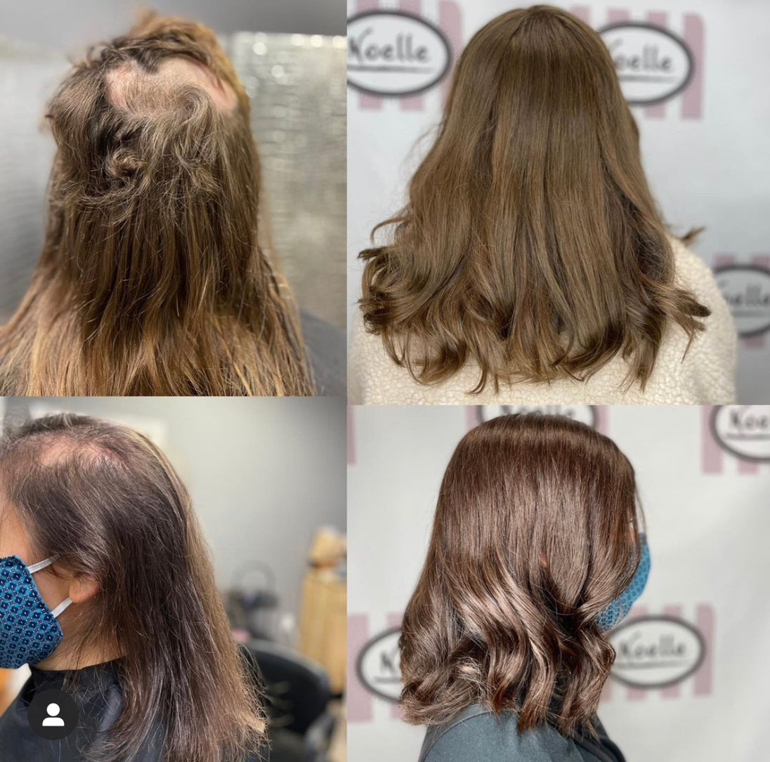 https://noellesalon.com/collections/all/products/free-hair-loss-consultation