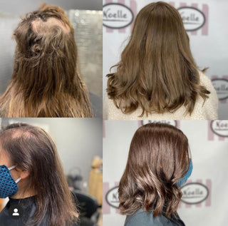 https://noellesalon.com/collections/all/products/free-hair-loss-consultation