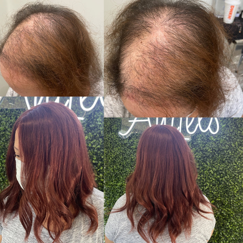 https://noellesalon.com/collections/all/products/free-hair-loss-consultation