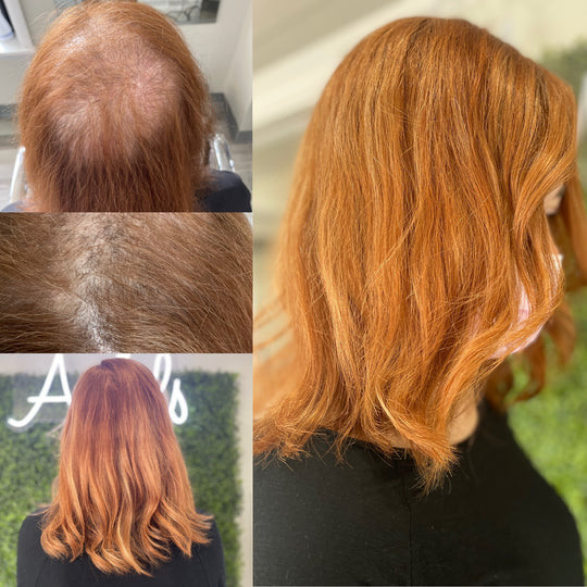  Hair Loss Solution Maintenance Or New Application