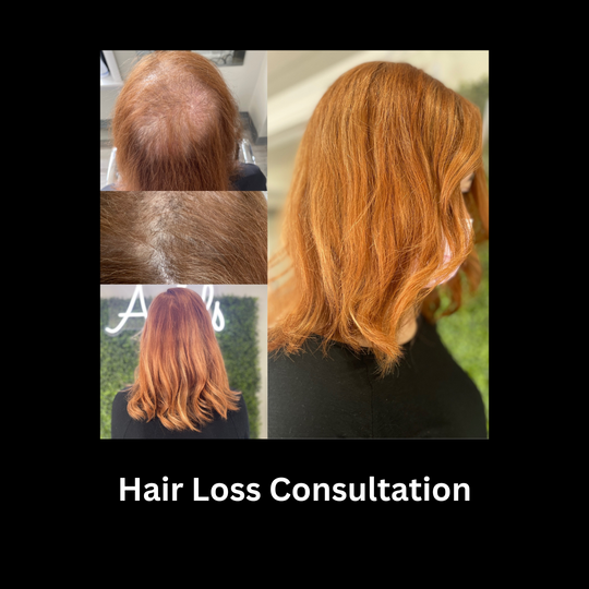 Free Hair Loss Consultation