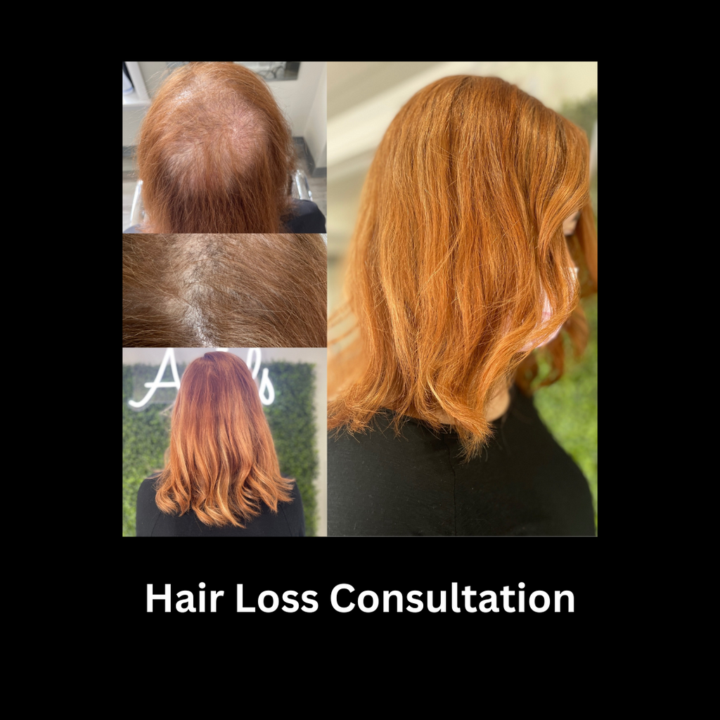 Free Hair Loss Consultation